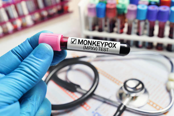 Global Initiative Launched to Improve Access to Monkeypox Vaccines